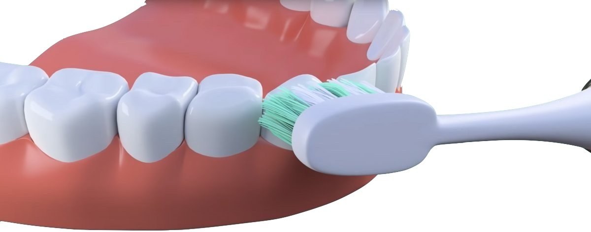 TrueLife SonicBrush UV, sonická zubná kefka - čistenie zubov